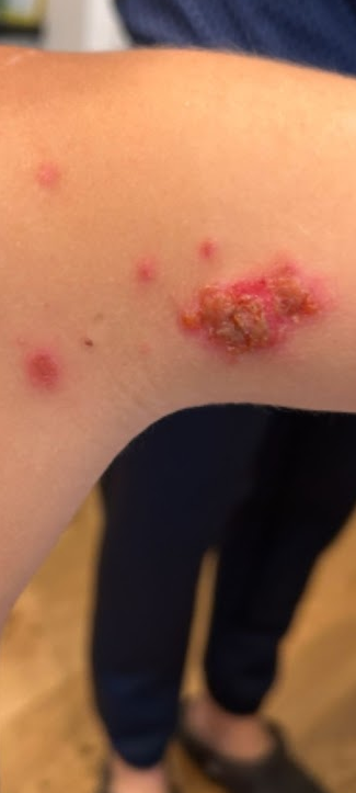 VisualDx Screenshot 3